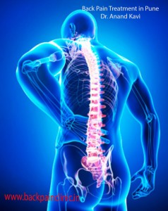 back pain treatment in pune