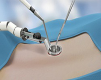 Back pain treatment in Pune