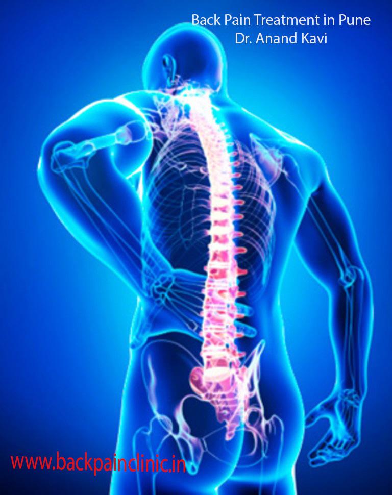 back pain treatment in pune